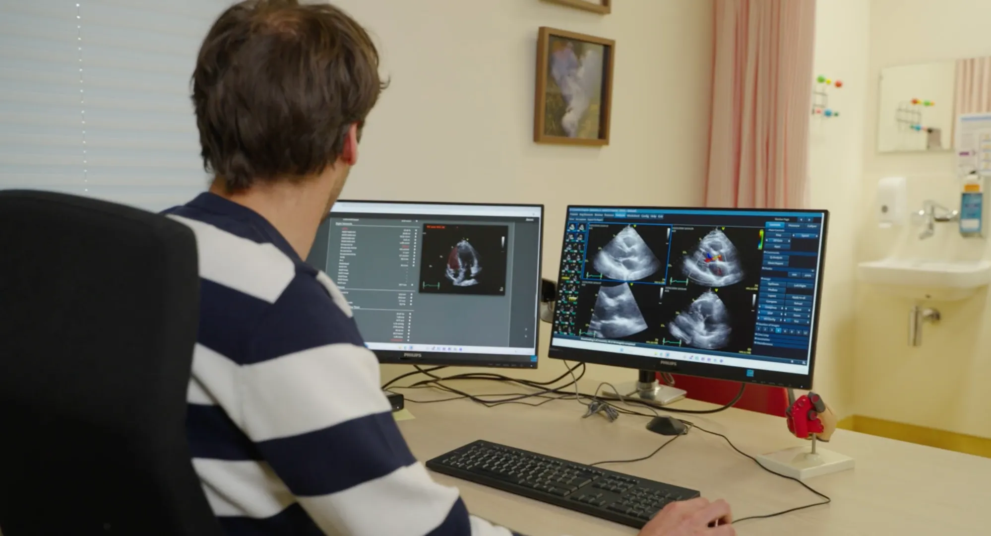 Wilhelmina Ziekenhuis Assen Renews Multi-Year Agreement with Us2.ai for AI-Powered Echocardiography