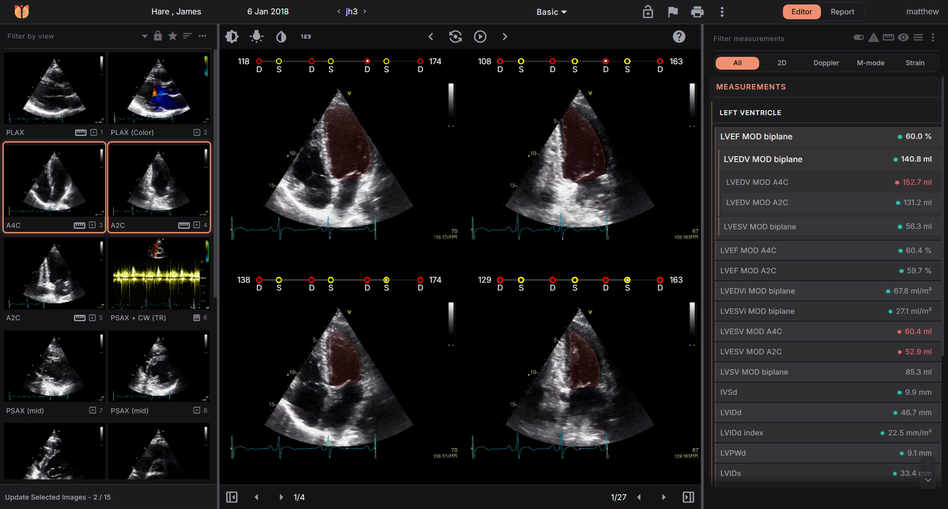 Us2.ai Connect Anywhere