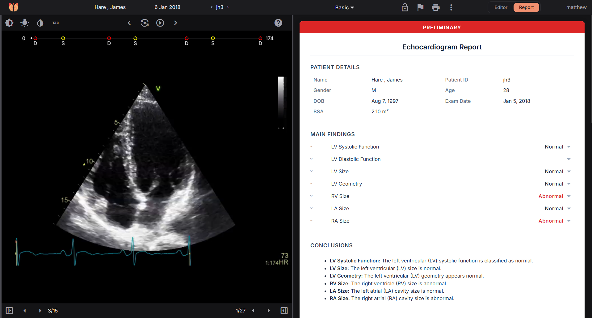 Us2.ai Automated Reporting